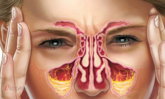什么原因引起鼻炎？